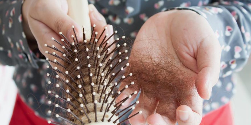 بررسی علل ریزش مو در مردان و زنان ریزش مو یک عارضه شایع و همه گیر است که در میان زنان و مردان مشاهده می شود. برای پیشگیری و درمان این عارضه راهکارهای درمانی